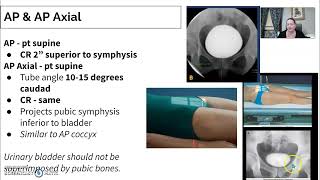 Urinary Imaging Radiology  3 Cystogram [upl. by Calabrese]