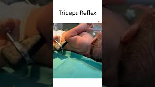 Triceps Reflex [upl. by Aleahc614]