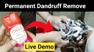 Anti Dandruff Medicated Shampoo Honest Review  Works Or Not  Conaz Lotion for Hair [upl. by Nosauq]