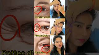 📛♨️Antiaging glowing skin yoga reduce eyebagseye wrinkles drooping eyelid 👀eyestry🤯it dailyshorts [upl. by Einittirb]