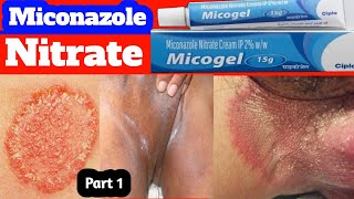 Fungal infection in private parts 🔥 jock itch treatment 💥 tinea cruris treatment 🔥 part1 [upl. by Travers269]