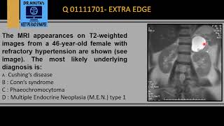 PHEOCHROMOCYTOMA MRI [upl. by Eissirc]