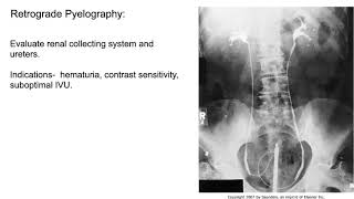 Radiology of the Urogenital system [upl. by Ardnuek449]