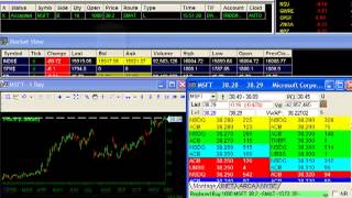 DAS Trader Tips Video RPL Button  Cancel and Replace feature [upl. by Adianes700]