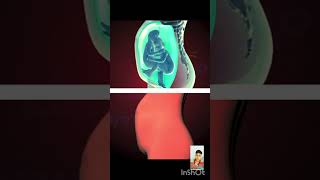 Babys Moments inside the womb 3D Animation fetalmovement shorts short [upl. by Jenks]