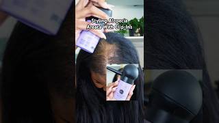 Styling My Alopecia Areata With ClipIns alopecia hairloss beauty [upl. by Adnawal233]