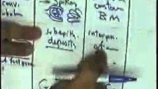 systemic pathology renal system 2 nephrotic DR SAMEH GHAZY [upl. by Daniel]