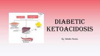 Diabetic ketoacidosis  causes signs and symptoms diagnostic criteria investigations treatment [upl. by Marcela]