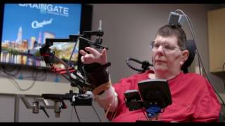 Man with quadriplegia employs injury bridging technologies to move again  just by thinking​ [upl. by Attelliw874]