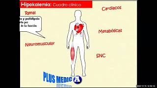 Clase 62  Semiología en la Hipo e Hiperkalemia  Hipo e Hipercalcemia [upl. by Airdnazxela]