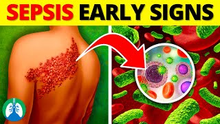 Top 10 Early Warning Signs of Sepsis  NEVER Ignore THIS [upl. by Koslo960]