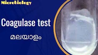 Coagulase test  malayalam [upl. by Gunas87]