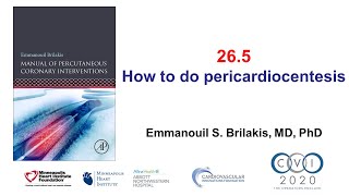 265 Manual of PCI  Pericardiocentesis [upl. by Adnaluoy]