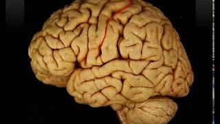 Sulci and Gyri of Lateral Surface of the Cerebral Hemisphere Practical  Dr Ahmed Farid [upl. by Free]