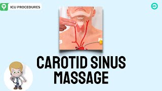 Carotid Sinus Massage What is it and How to perform the procedure [upl. by Yaj]