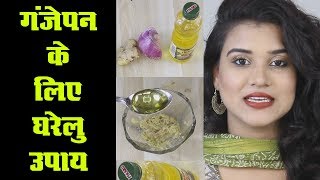 Home Remedy for Baldness Hindi [upl. by Lavinia]