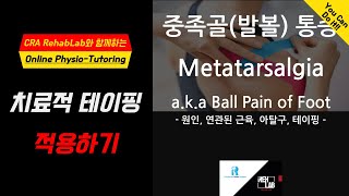 중족골통증 발볼통증Metatarsalgia 치료적 테이핑 적용하기 중족골통증 발볼통증 metatarsalgia footpain kinesiotape 통증완화 [upl. by Naginarb25]