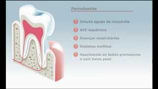 O Periodonto  Periodontuscombr [upl. by Atreb]