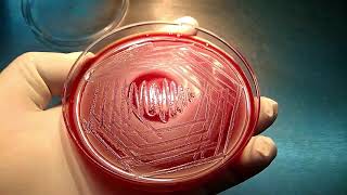 Enterococcus on blood agar [upl. by Sprague]