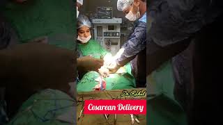 Cesarean Dr Rahul Gynecologist birthvlogs deliveryvlogs [upl. by Ermanno]