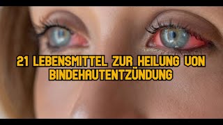 21 Lebensmittel zur Heilung von Bindehautentzündung [upl. by Litman191]