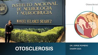 OTOSCLEROSIS  ENARM 2025  GPC [upl. by Enyawud663]