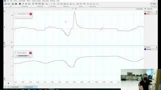 Spirometry demonstration [upl. by Chery]