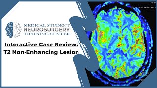 Interactive Case Review T2 NonEnhancing Lesion [upl. by Rasmussen]