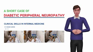 Diabetic Peripheral Neuropathy [upl. by Jess]