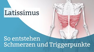 Latissimus Schmerzen Triggerpunkte und deren Aktivierung [upl. by Aleahcim491]