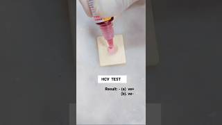 HCV Test kaise hota hai ⚕️🥼 shortstrendingshortsr2mpharmacy viralvideohospitalhospitalpharmacy [upl. by Aneema974]