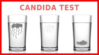 Do You Have Candida Take The quotSpit Testquot [upl. by Colvert348]