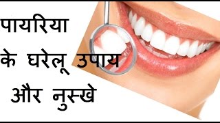 पायरिया के घरेलू उपाय और नुस्खे  Home Remedies for Pyorrhea [upl. by Nahsyar928]