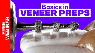 Basic principles in veneer preps FREE Webinar [upl. by Dalury]