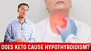 Does the Ketogenic Diet Cause Hypothyroidism or Hashimoto’s Thyroiditis – Dr Berg [upl. by Adnohsal]