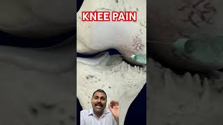 For people who requested knee injection video in hindhi [upl. by Enert]