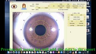 How To Use USB Iriscope Iris Analyzer Iridology Camera Software  Video Tutorial For Iridologist [upl. by Lindy]