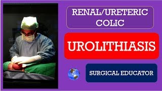 UROLITHIASIS How To DIAGNOSE amp TREAT RENAL URETERIC COLIC [upl. by Pearce]