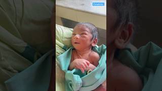 Abnormal Newborn Baby video medical viralvideo [upl. by Nylatsyrc]