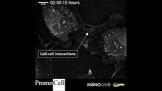 Protrusions in Human Umbilical Vein Endothelial Cells with Nanolive imaging [upl. by Ametaf]