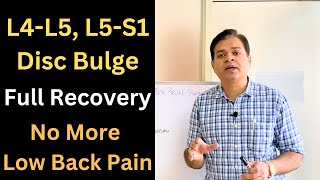 5 Steps For Disc Bulge Treatment Low Back Pain Full Recovery Herniated Disc Recovery Part1 [upl. by Kearney]