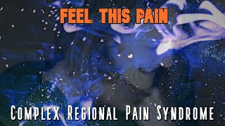 Complex Regional Pain Syndrome Feel This Pain S2E2 [upl. by Ayim]