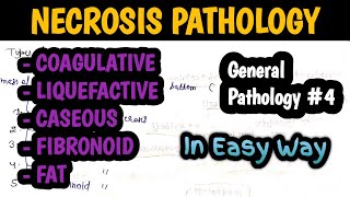 Necrosis Pathology  Types of Necrosis  Cell injury pathology  General Pathology 4 [upl. by Grim661]