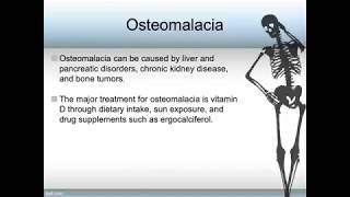 Osteroporosis and Osteomalacia [upl. by Debera]