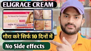 Eligrace cream use dose benefits and side effects full review in hindi [upl. by Sydel]