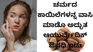 ಚರ್ಮದ ಆರೋಗ್ಯಕ್ಕೆ ಅಳಲೆಕಾಯಿ  Harad Benefits For Skin  Alalekai Uses In Kannada  Alalekayi Benefits [upl. by Terraj]