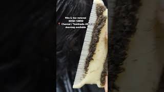 Nits lice treatment 💯 result Chennai amp doorstep available headlicetreatmentliceremovalnitslice [upl. by Sarilda]