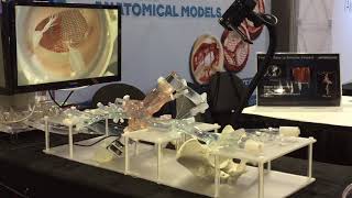 Enhanced Transseptal Mitral Model [upl. by Enoch]