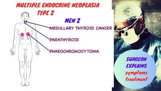 Multiple Endocrine Neoplasia  Type II MEN 2 [upl. by Alric]