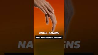 10 Nail Warning Signs You Should Never Ignore for Your Health healthtips health short [upl. by Ayerim109]